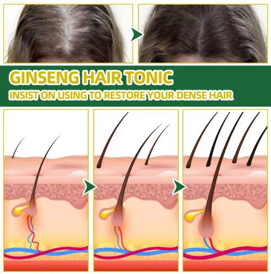 Ouhoe Ginseng Hair Growth Serum Oil - bottle